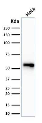 Western Blot: Cytokeratin 7 Antibody (SPM270) [NBP2-44815]