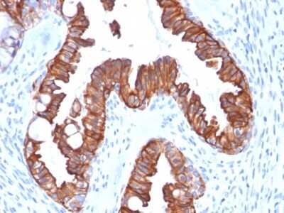Immunohistochemistry-Paraffin: Cytokeratin 7 Antibody (rOV-TL12/30) - Azide and BSA Free [NBP2-54499]