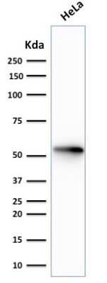 Western Blot: Cytokeratin 7 Antibody (rOV-TL12/30)Azide and BSA Free [NBP2-54499]