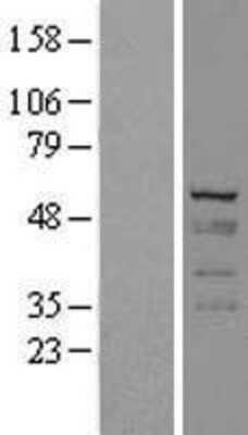 Western Blot: Cytokeratin 7 Overexpression Lysate [NBL1-12396]