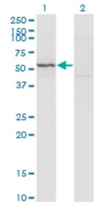 Western Blot: Cytokeratin 71 Antibody (1D4) [H00112802-M02]