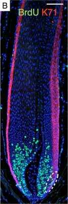 Immunocytochemistry/ Immunofluorescence: Cytokeratin 71 Antibody [NBP2-17040]