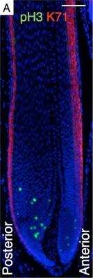 Immunocytochemistry/ Immunofluorescence: Cytokeratin 71 Antibody [NBP2-17040]