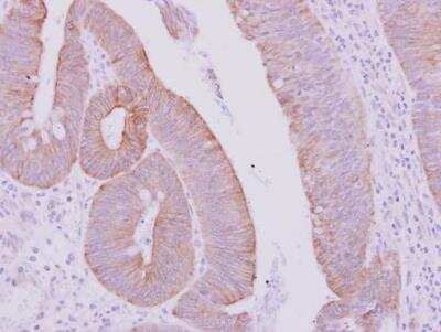 Immunohistochemistry-Paraffin: Cytokeratin 71 Antibody [NBP2-17040]