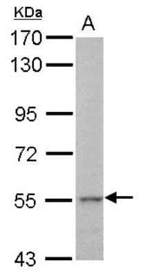 Western Blot: Cytokeratin 71 Antibody [NBP2-17040]