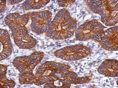 Immunohistochemistry-Paraffin: Cytokeratin 72 Antibody [NBP2-42833]