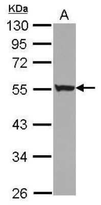 Western Blot: Cytokeratin 72 Antibody [NBP2-42833]