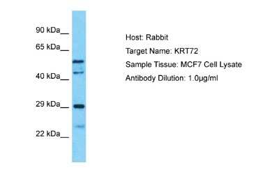 Western Blot: Cytokeratin 72 Antibody [NBP2-84754]