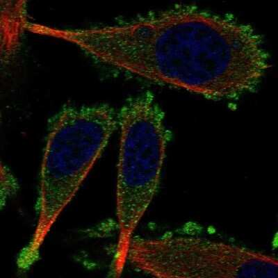 Immunocytochemistry/ Immunofluorescence: Cytokeratin 75 Antibody [NBP2-56047]