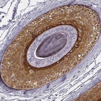 Immunohistochemistry-Paraffin: Cytokeratin 75 Antibody [NBP1-87845]