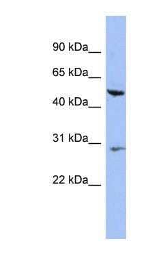 Western Blot: Cytokeratin 75 Antibody [NBP1-55236]