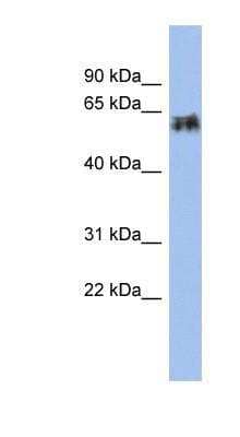 Western Blot: Cytokeratin 75 Antibody [NBP1-55237]