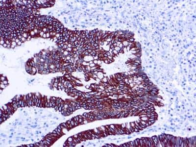 Immunohistochemistry-Paraffin: Cytokeratin 8/18 Antibody (5D3) [NB120-17139]