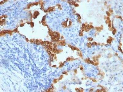 Immunohistochemistry-Paraffin: Cytokeratin 8/18 Antibody (B22.1/B23.1) - IHC-Prediluted [NBP2-48180]