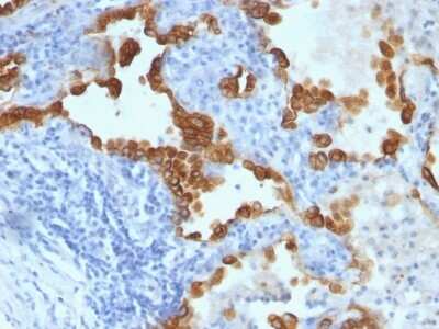 Immunohistochemistry-Paraffin: Cytokeratin 8/18 Antibody (B22.1/B23.1) [NBP2-44928]