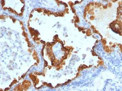 Immunohistochemistry-Paraffin: Cytokeratin 8/18 Antibody (C-43 + DC10) - Azide and BSA Free [NBP2-47982]