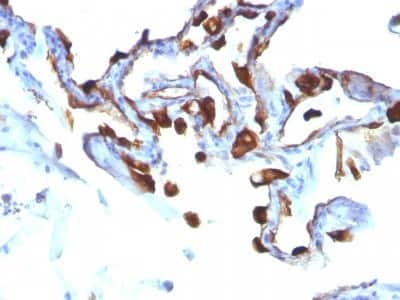 Immunohistochemistry-Paraffin: Cytokeratin 8/18 Antibody (C-51) [NBP2-44929]