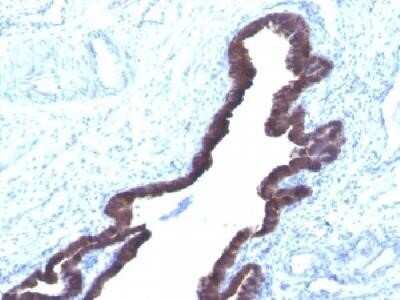 Immunohistochemistry-Paraffin: Cytokeratin 8/18 Antibody (K8.8 + DC10) - Azide and BSA Free [NBP2-34655]