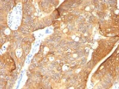 Immunohistochemistry-Paraffin: Cytokeratin 8/18 Antibody (K8.8 + DC10) - Azide and BSA Free [NBP2-34655]