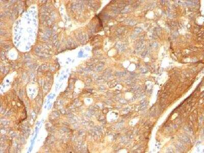 Immunohistochemistry-Paraffin: Cytokeratin 8/18 Antibody (K8.8 + DC10) [NBP2-34344]