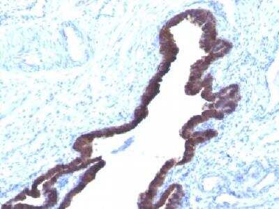 Immunohistochemistry-Paraffin: Cytokeratin 8/18 Antibody (K8.8 + DC10) [NBP2-34344]