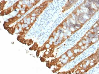 Immunohistochemistry-Paraffin: Cytokeratin 8/18 Antibody (KRT8.18/2297R) - Azide and BSA Free [NBP3-08918]