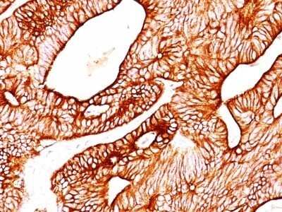 Immunohistochemistry-Paraffin: Cytokeratin 8/18 Antibody (KRT8/803 + KRT18/835) - Azide and BSA Free [NBP2-47983]