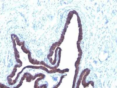 Immunohistochemistry-Paraffin: Cytokeratin 8/18 Antibody (KRT8/803 + KRT18/835) - Azide and BSA Free [NBP2-47983]