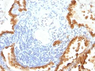 Immunohistochemistry-Paraffin: Cytokeratin 8/18 Antibody (KRT8/803 + KRT18/835) [NBP2-44930]