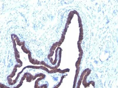 Immunohistochemistry-Paraffin: Cytokeratin 8/18 Antibody (KRT8/803 + KRT18/835) [NBP2-44930]