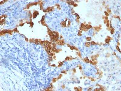 Immunohistochemistry-Paraffin: Cytokeratin 8/18 Antibody (SPM141) - IHC-Prediluted [NBP2-48211]