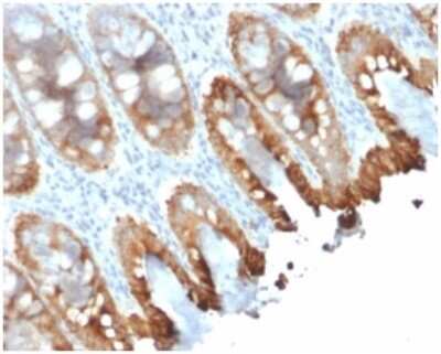 Immunohistochemistry-Paraffin: Cytokeratin 8/18 Antibody (rKRT8.18/1346) - Azide and BSA Free [NBP3-08300]