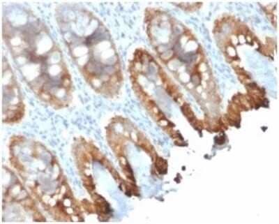 Immunohistochemistry-Paraffin: Cytokeratin 8/18 Antibody (rKRT8.18/1346) [NBP3-07851]