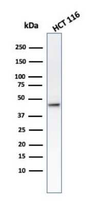 Western Blot: Cytokeratin 8 Antibody (B22.1)Azide and BSA Free [NBP3-11566]