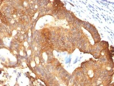 Immunohistochemistry-Paraffin: Cytokeratin 8 Antibody (B22.1) - IHC-Prediluted [NBP2-48146]