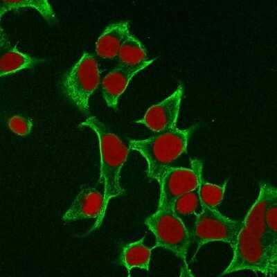 Immunocytochemistry/ Immunofluorescence: Cytokeratin 8 Antibody (B22.1) [NBP2-44931]