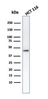 Western Blot: Cytokeratin 8 Antibody (B22.1) [NBP2-44931]