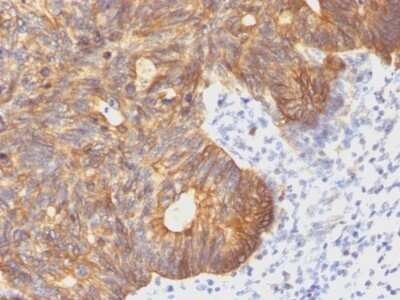 Immunohistochemistry-Paraffin: Cytokeratin 8 Antibody (C-43) - IHC-Prediluted [NBP2-48169]