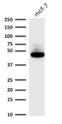 Western Blot: Cytokeratin 8 Antibody (C-43) [NBP2-44938]