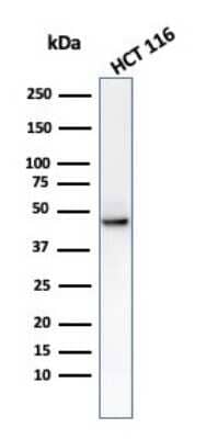 Western Blot: Cytokeratin 8 Antibody (C-43) [NBP2-44938]