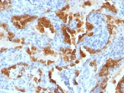 Immunohistochemistry-Paraffin: Cytokeratin 8 Antibody (H1+TS1) [NBP2-34268]