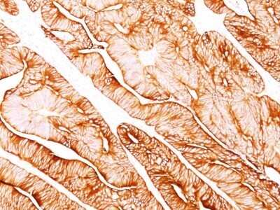 Immunohistochemistry-Paraffin: Cytokeratin 8 Antibody (H1) - Azide and BSA Free [NBP2-34626]