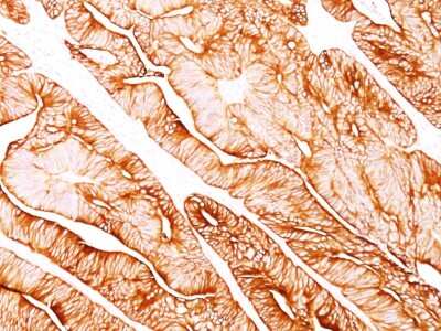Immunohistochemistry-Paraffin: Cytokeratin 8 Antibody (H1) [NBP2-34265]
