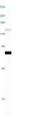Simple Western: Cytokeratin 8 Antibody (H1) [NBP2-34265]