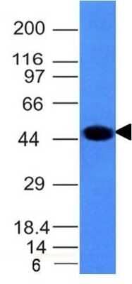 Western Blot: Cytokeratin 8 Antibody (H1) [NBP2-34265]