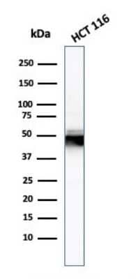 Western Blot: Cytokeratin 8 Antibody (H1) [NBP2-34265]