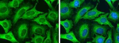 Immunocytochemistry/ Immunofluorescence: Cytokeratin 8 Antibody [NBP2-16094]