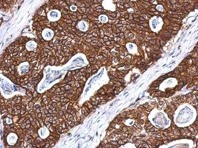 Immunohistochemistry-Paraffin: Cytokeratin 8 Antibody [NBP2-16094]