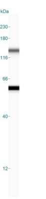 Simple Western: Cytokeratin 8 Antibody (K8/383)Azide and BSA Free [NBP2-34656]