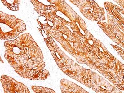 Immunohistochemistry-Paraffin: Cytokeratin 8 Antibody (K8/383) - IHC-Prediluted [NBP2-44934]